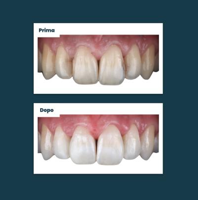 Estetica Sorriso Aufiero Caso 08