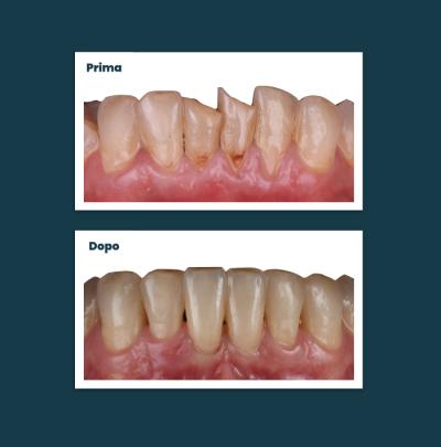 Estetica Sorriso Aufiero Caso 10
