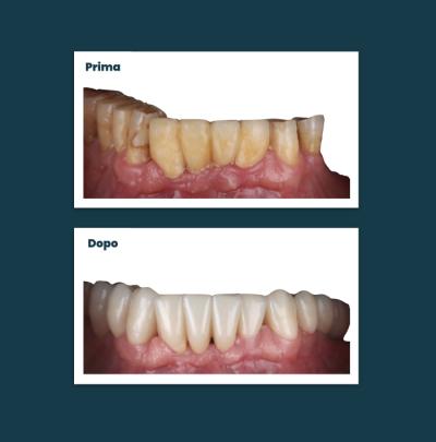 Estetica Sorriso Aufiero Caso 12